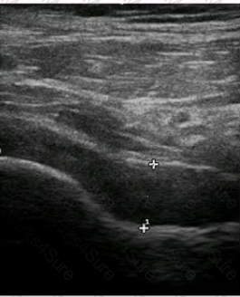 RhMSUS Question 6